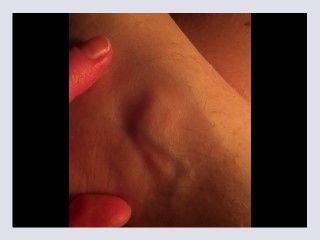 My Veiny Foot   Touching the Veins to Demonstrate the Flow