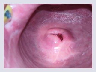 Cervix close up 4k