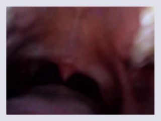 Mouth Endoscope 9b1